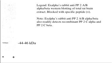 "Legend: Exalpha’s rabbit anti PP 2 A/B alpha/beta western blotting of total rat brain extract. Blocked with specific peptide (+).
Note: Exalpha’s rabbit anti PP 2 A/B alpha/beta also readily detects recombinant PP 2 C alpha and PP 2 C beta."